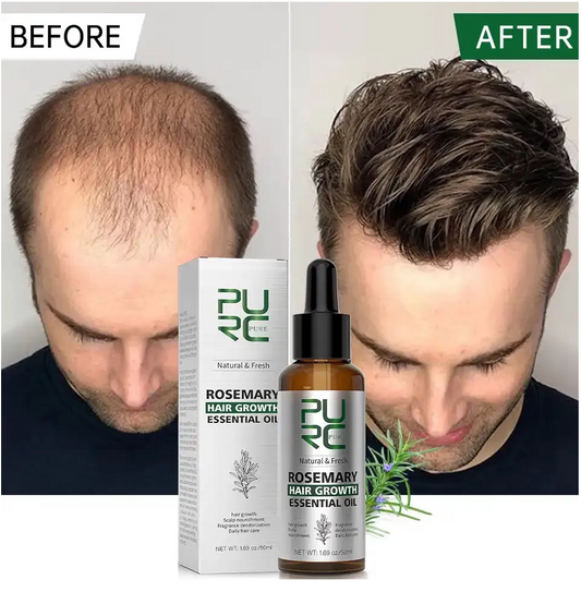 Rosemary Oil Hair Growth Oil